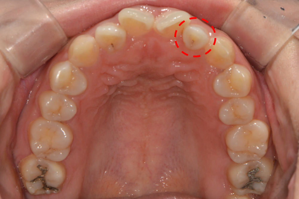 a79642d4c465296dc3eab8eae7d012ea 1763368877 1869