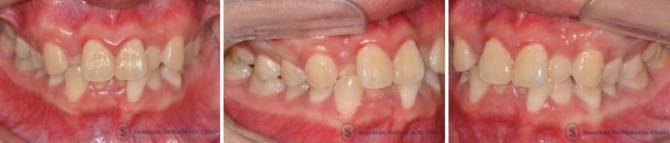 35653dcbafd820f14ced44ed9eab5a01 1766362631 0323 35653dcbafd820f14ced44ed9eab5a01 1766362631 0323