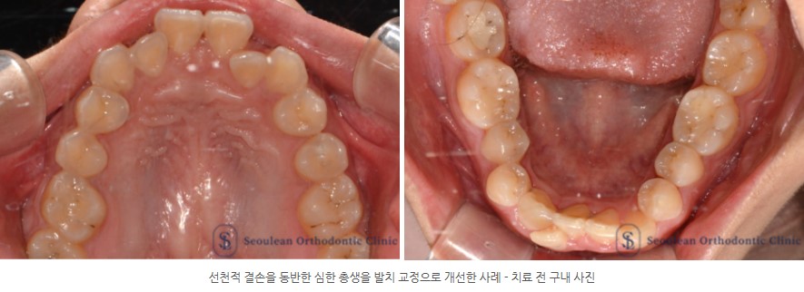 35653dcbafd820f14ced44ed9eab5a01 1766362631 0632 35653dcbafd820f14ced44ed9eab5a01 1766362631 0632