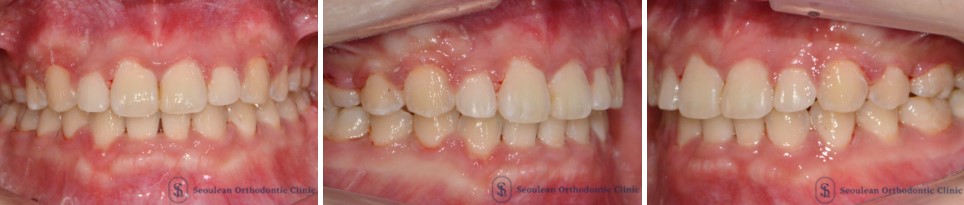 35653dcbafd820f14ced44ed9eab5a01 1766362631 125 35653dcbafd820f14ced44ed9eab5a01 1766362631 125