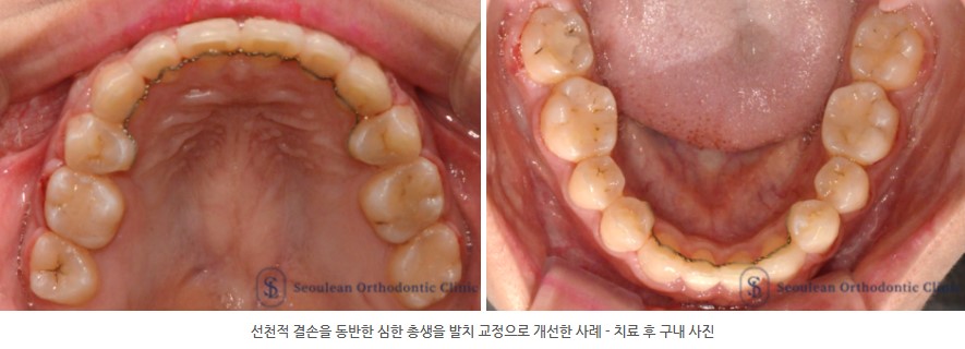 35653dcbafd820f14ced44ed9eab5a01 1766362631 1531 35653dcbafd820f14ced44ed9eab5a01 1766362631 1531