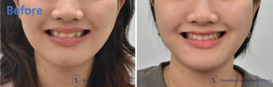 35653dcbafd820f14ced44ed9eab5a01 1766362631 182 35653dcbafd820f14ced44ed9eab5a01 1766362631 182