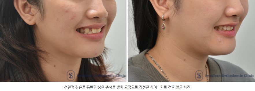 35653dcbafd820f14ced44ed9eab5a01 1766362631 2652 35653dcbafd820f14ced44ed9eab5a01 1766362631 2652