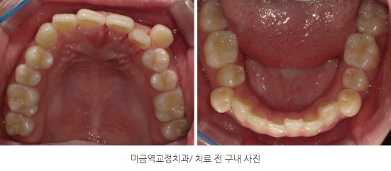 35653dcbafd820f14ced44ed9eab5a01 1766366317 9985