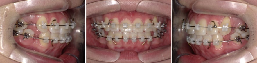 35653dcbafd820f14ced44ed9eab5a01 1766366318 0266