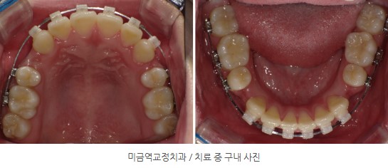 35653dcbafd820f14ced44ed9eab5a01 1766366318 0544