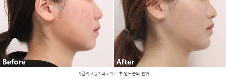 35653dcbafd820f14ced44ed9eab5a01 1766366318 1081