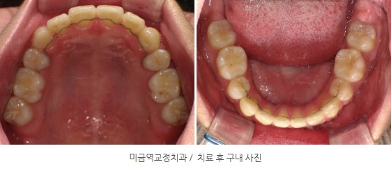 35653dcbafd820f14ced44ed9eab5a01 1766366941 0807