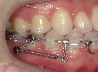 76a4d2e55ee3469531d0443854bad679 1766106889 1228