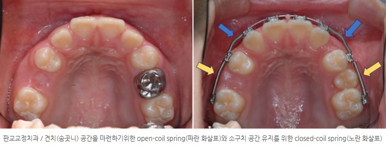 76a4d2e55ee3469531d0443854bad679 1766106889 2378