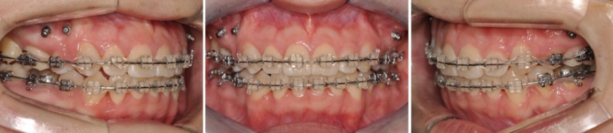 9e3faaa72c89c510a1e3a8e42b7d5ac3 1766449083 0115