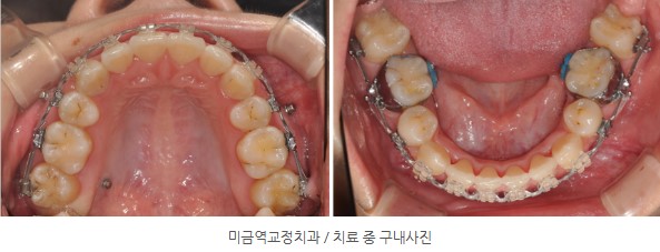 9e3faaa72c89c510a1e3a8e42b7d5ac3 1766449083 0393