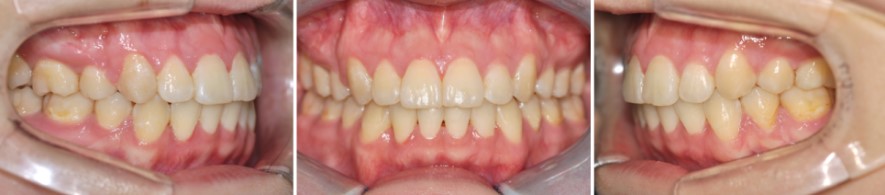 9e3faaa72c89c510a1e3a8e42b7d5ac3 1766449083 0672