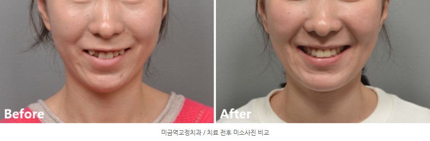 9e3faaa72c89c510a1e3a8e42b7d5ac3 1766449083 1225