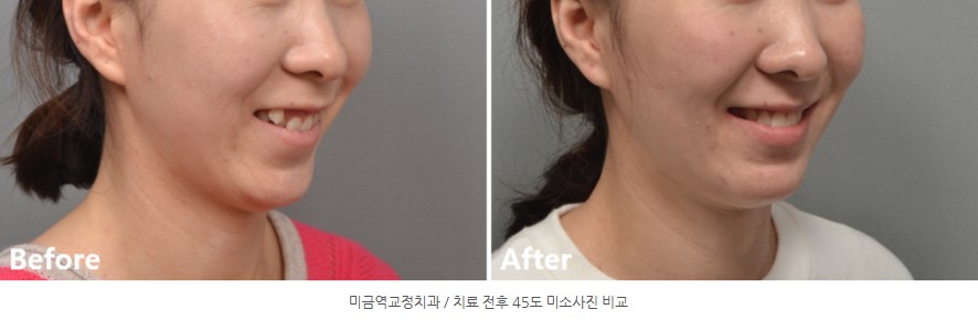 9e3faaa72c89c510a1e3a8e42b7d5ac3 1766449083 1521