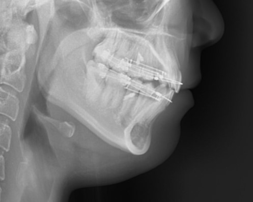 a80d772a75d836b941fef90163cf0804_1765504205_1137.jpg a80d772a75d836b941fef90163cf0804_1765504205_1137.jpg