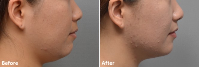 a80d772a75d836b941fef90163cf0804_1765504205_2419.jpg a80d772a75d836b941fef90163cf0804_1765504205_2419.jpg