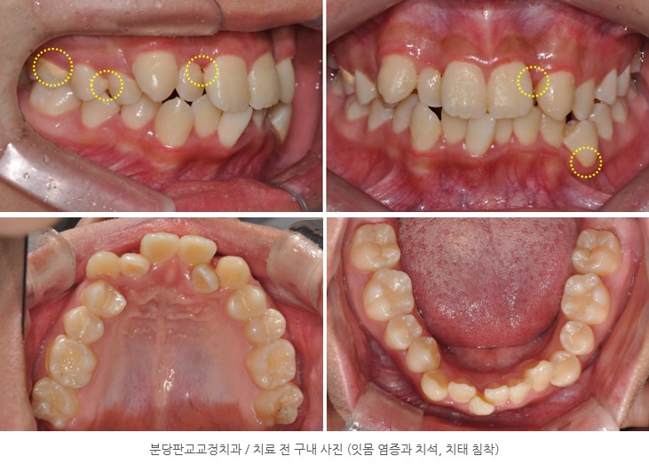 d77176e5a4b3568a3d85fbca21547b20 1767339342 336 d77176e5a4b3568a3d85fbca21547b20 1767339342 336