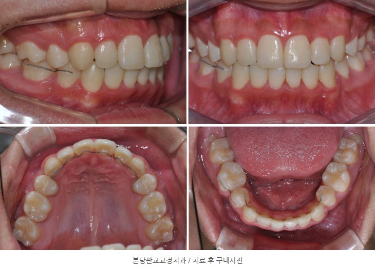 d77176e5a4b3568a3d85fbca21547b20 1767339342 3987 d77176e5a4b3568a3d85fbca21547b20 1767339342 3987