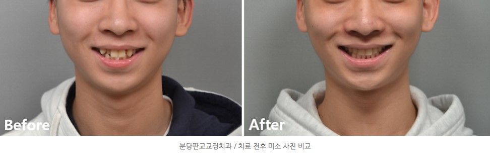 d77176e5a4b3568a3d85fbca21547b20 1767339342 4283 d77176e5a4b3568a3d85fbca21547b20 1767339342 4283