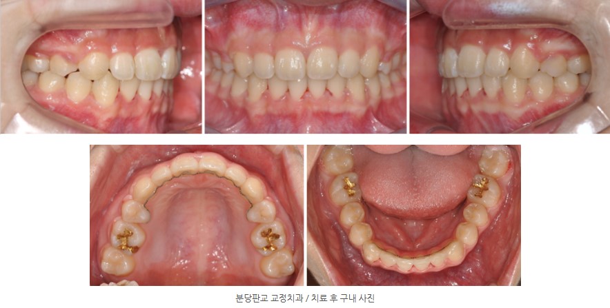 4d1c8a74687396c7c5f2efe3b5f96a6e 1771550819 7509