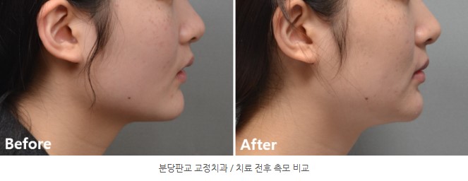 4d1c8a74687396c7c5f2efe3b5f96a6e 1771550819 7765