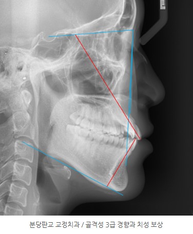 7c95dc239153d1786d4e48f534b30189 1771984549 8864 7c95dc239153d1786d4e48f534b30189 1771984549 8864