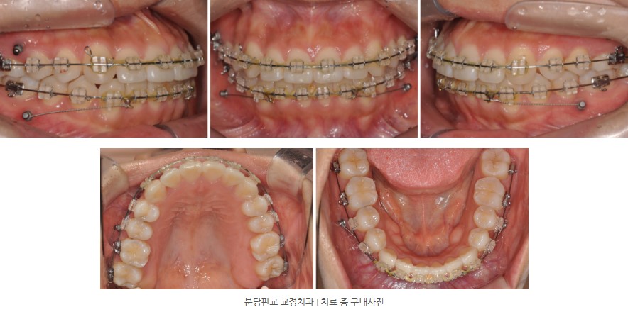 7c95dc239153d1786d4e48f534b30189 1771984549 9376 7c95dc239153d1786d4e48f534b30189 1771984549 9376