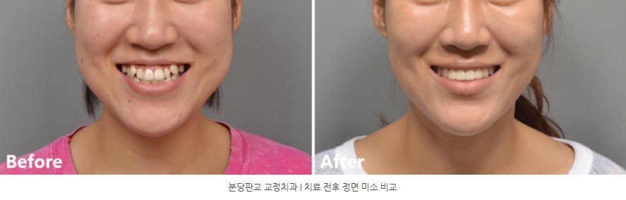 7c95dc239153d1786d4e48f534b30189 1771984550 0181 7c95dc239153d1786d4e48f534b30189 1771984550 0181