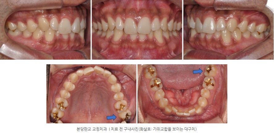 9974014fde9c3829d69e8c0fa8973d5b 1773967001 5773