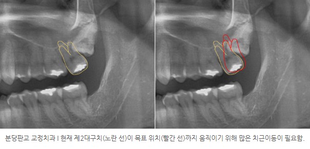 9974014fde9c3829d69e8c0fa8973d5b 1773967001 6756