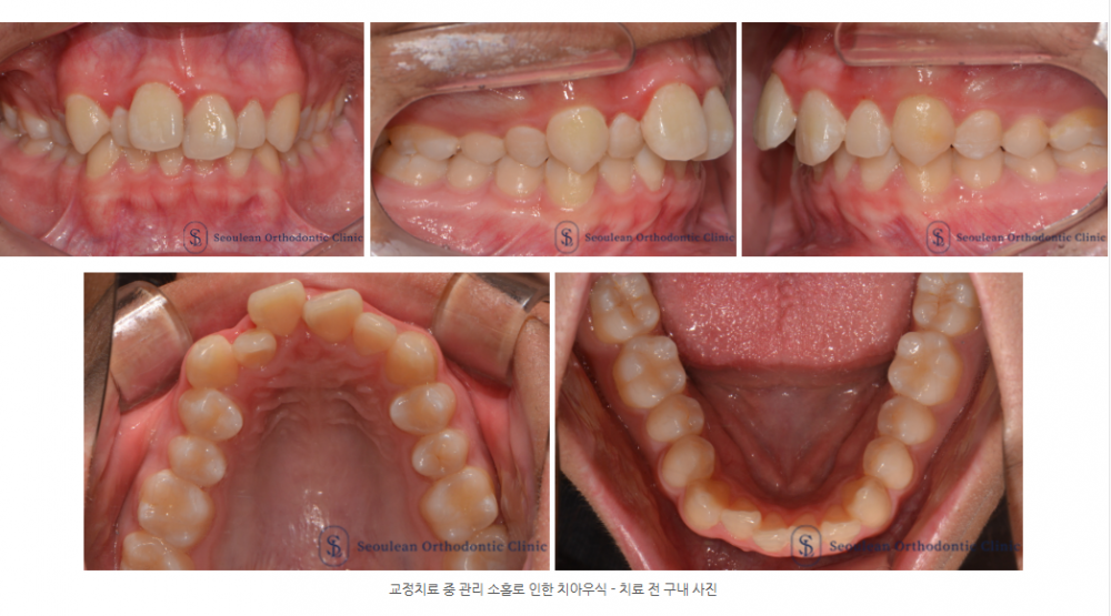 326aab029ba46e40e42ae42374d84528 1773107929 1875