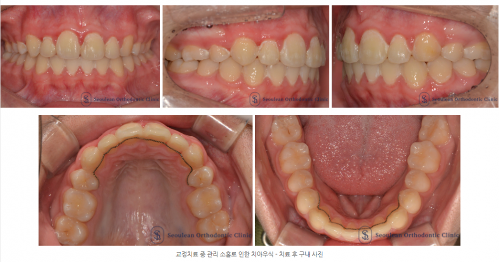 326aab029ba46e40e42ae42374d84528 1773107952 3005