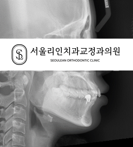 돌출입 교정치료 전후 엑스레이 사진 I 분당교정치과